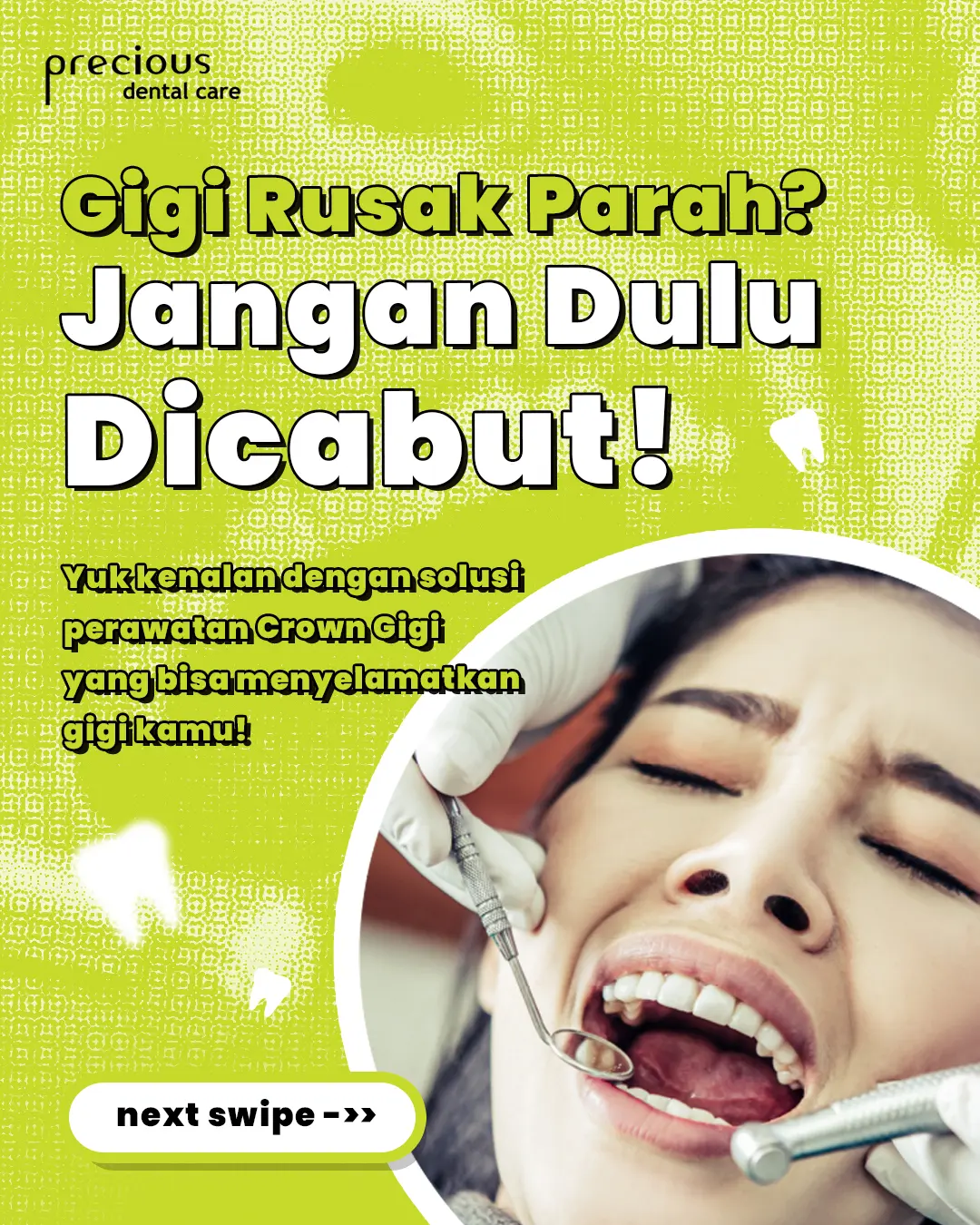 Post thumbnail gigi rusak parah